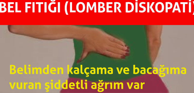 Bel fıtığı (lomber diskopati)